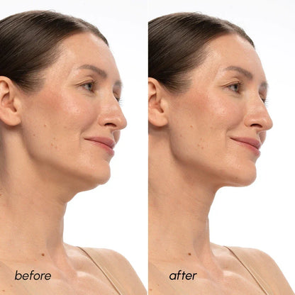 PDRN V-line Lifting Mask